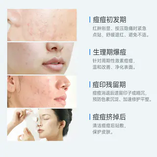话肤 HUAFU清痘净肤修护贴祛痘减少粉刺保湿温和补水痘痘肌专研 1元 - 86线报 话肤 HUAFU清痘净肤修护贴祛痘减少粉刺保湿温和补水痘痘肌专研 1元 - 86线报