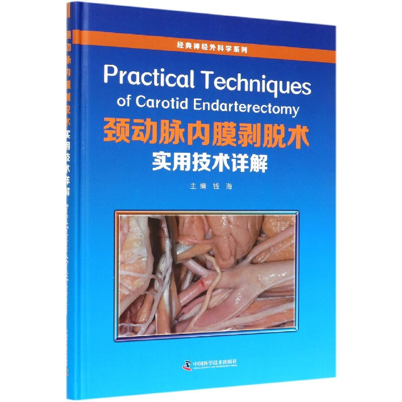 颈动脉内膜剥脱术实用技术详解(精)/经典神经外科学系列 50.4元