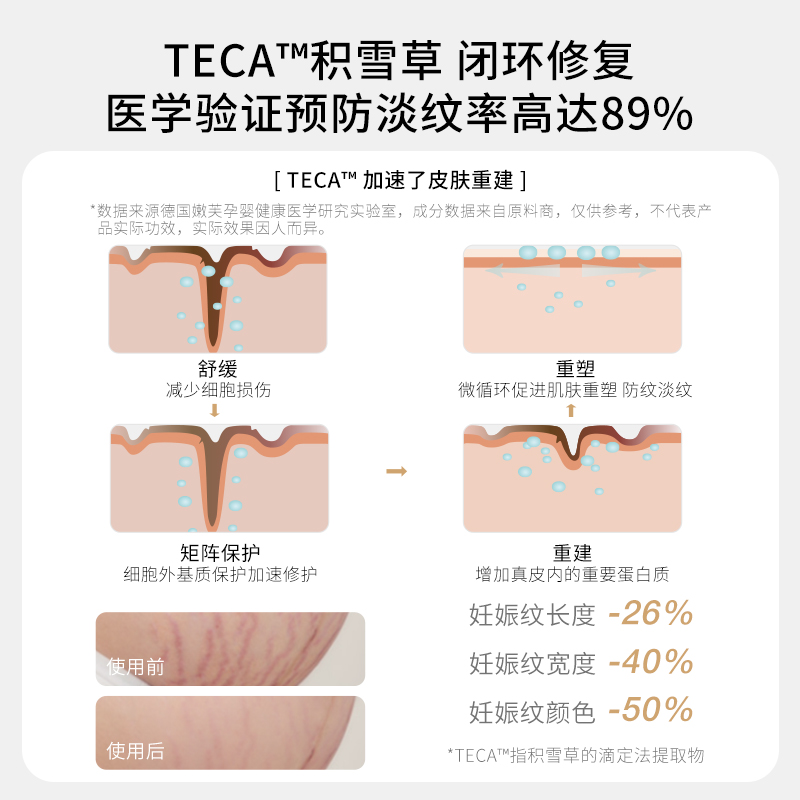 嫩芙 TENDER'FLOWER 临期特价德国嫩芙叶酸孕妇专用预防淡化妊娠纹乳霜期25年9