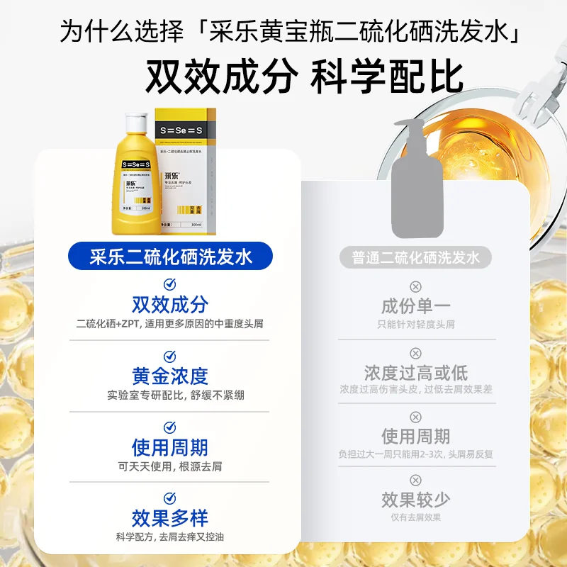 采乐 去屑止痒控油 洗发水300ml 14.9元 - 86线报