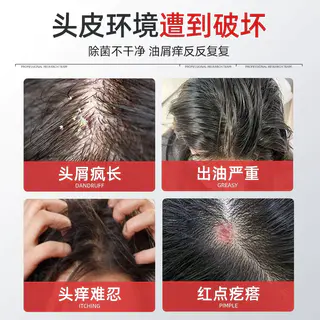采乐 去屑洗发露 丝质顺滑 33.03元 - 线报酷 采乐 去屑洗发露 丝质顺滑 33.03元 - 线报酷