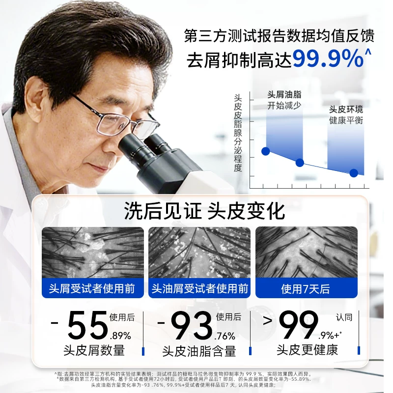 采乐 去屑止痒控油 洗发水300ml 14.9元 - 86线报