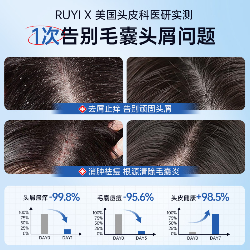 RUYI 儒意 二硫化硒洗发水去屑止痒控油蓬松除螨洗头膏露官方旗舰店正品男