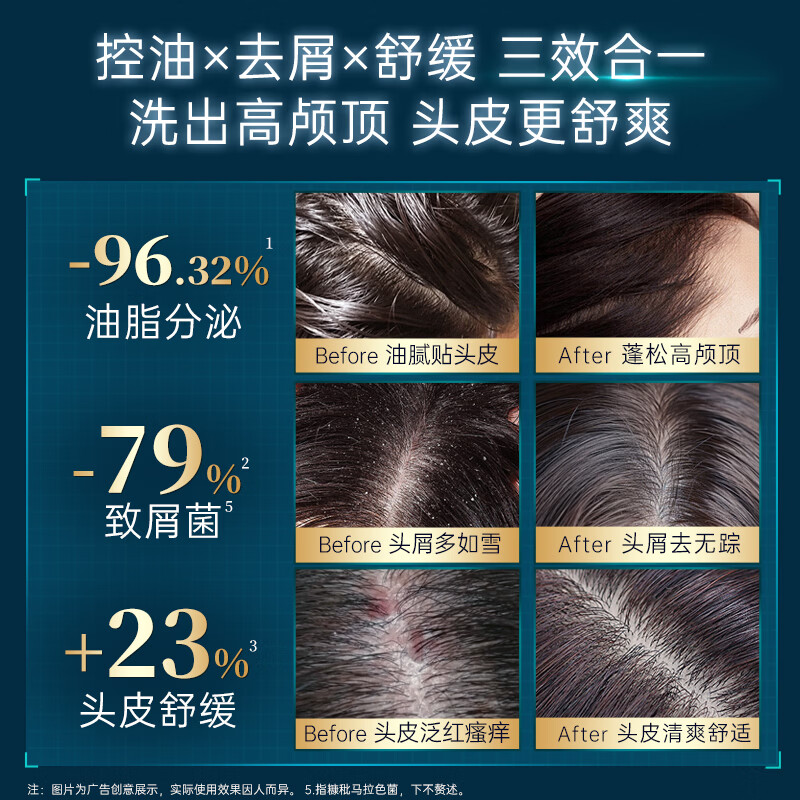 CABELO 去屑止痒洗发水350ml控油去屑 29.9元 - 线报酷