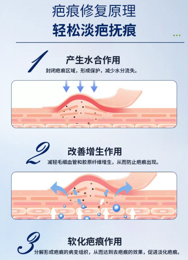 ReKeyMed 美国进口医用硅酮凝胶 1支装