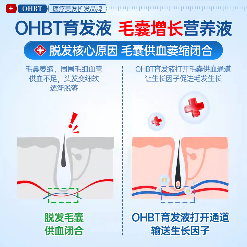 OHBT 胖东来育发液头发际线营养剂发快速增长男女生防脱神器侧柏叶精华 75.0