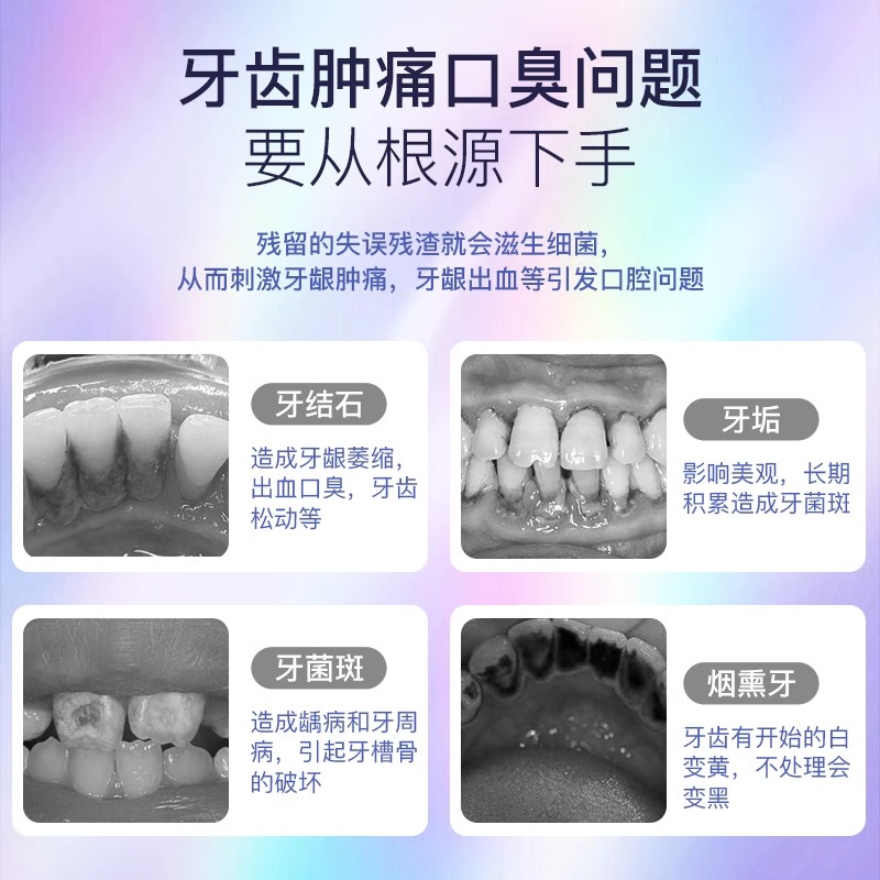 neward 声波可视洗牙器洁牙仪冲牙结石去除神器牙齿清洁污垢除牙垢 65.55元