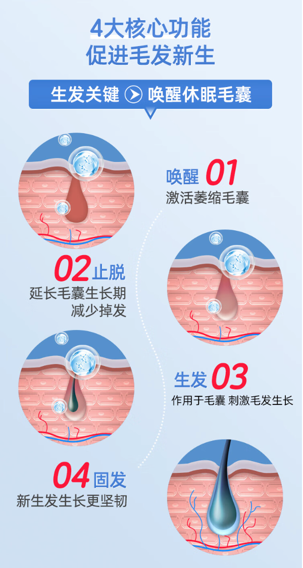 蔓迪 生发喷雾90ml*4瓶5%米诺地尔酊